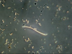 Диатомея, КФ-4М, 20х, АУ-26 1.1х копия.jpg