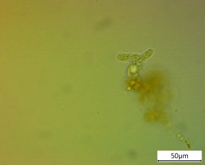 amoeba.jpg