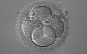 OlympusReliefContrast.jpg