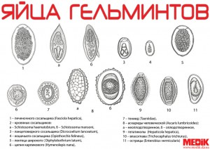 Glisti22.jpg