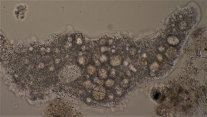 Amoeba.jpg