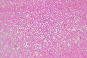 imgonline-com-ua-CompressBySize-xLq1ecOVw0Tm9f.jpg
