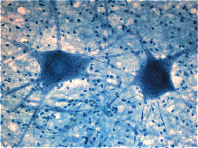 neurous.jpg