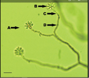 Anthophysa vegetans.jpg