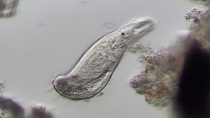 Инфузория Metopus.jpg