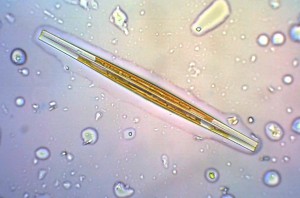 Diatom.jpg