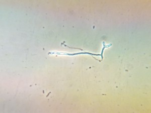 BIOLAR_полож_фаз_контр_625_2.jpg