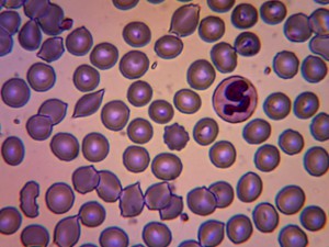 Blood smear 03.jpg