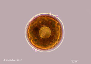 Arcella_vulgaris_PHV_900pcs.jpg