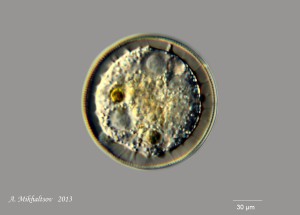 Arcella_vulgaris_DIK_900pcs.jpg