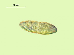Achnanthes intermedia 1.jpg