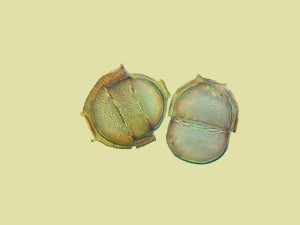 Melosira nummuloides 2.jpg
