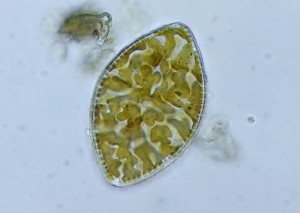 Cymatopleura elliptica.jpg