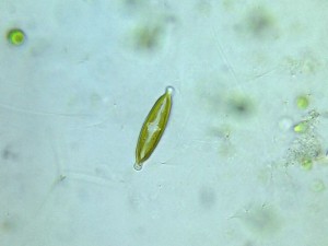 Anomoeoneis sphaerophora.jpg