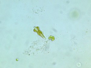 Gomphonema acuminatum1.jpg