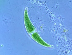 Closterium2 phv20.jpg