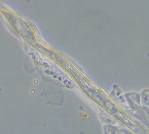 P1150280-кф5_2_кольца_1.jpg