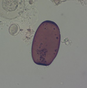 Раковинная  амёба  Archerella  flavum.JPG