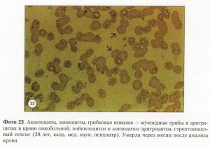 Перспективная диагностика (Свищева Т.Я.)_p01.jpg